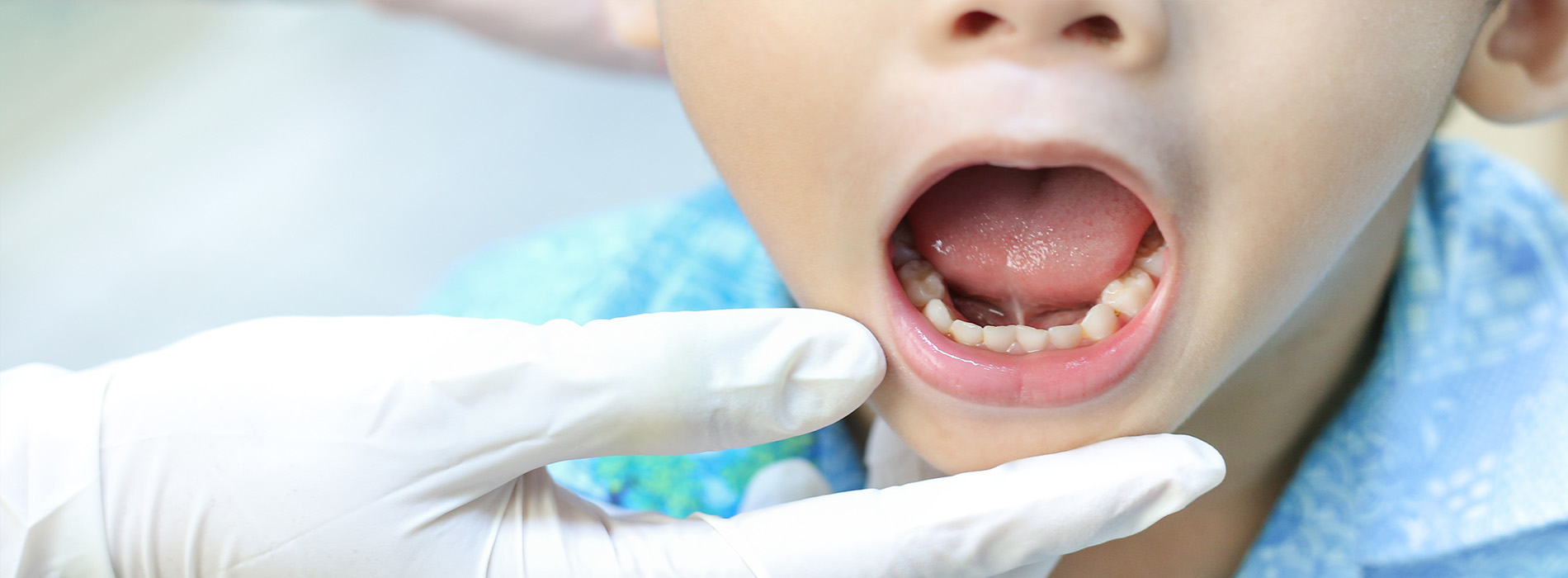 A young child receiving dental care, with a dental professional s hand visible in the foreground holding a dental tool.